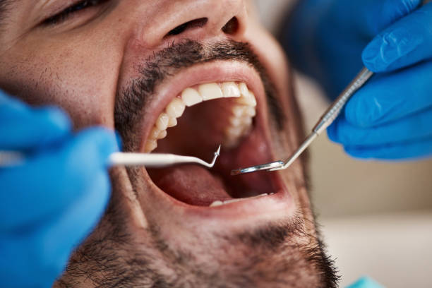 Best Emergency Care for Gum Disease in Fox Island, WA